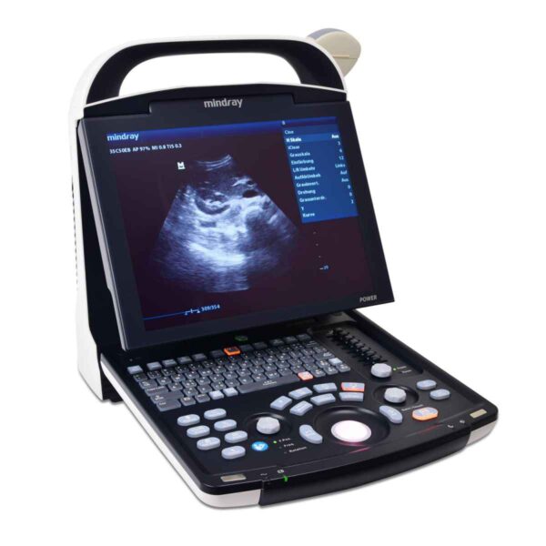 DP 10 ULTRASOUND